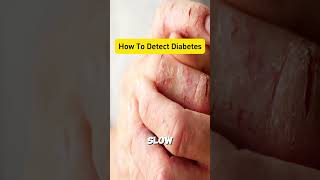 How to Detect Diabetes [upl. by Nirol]