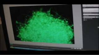 Lyme Biofilm [upl. by Genisia]