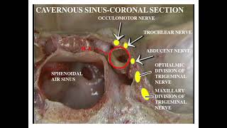 Sphenoid Bone [upl. by Enirrok]