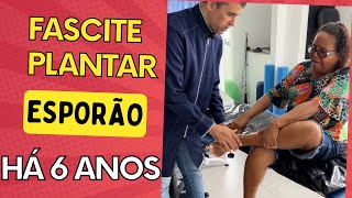 ESPORÃO DE CALCÂNEO E FASCITE PLANTAR  6 ANOS 😱 [upl. by Irahs365]