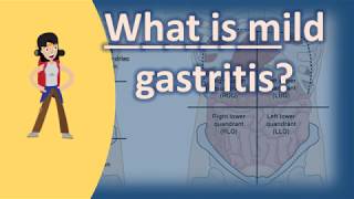 What is mild gastritis   Best and Top Health Answers [upl. by Carlson337]