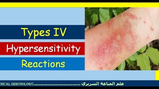 Lecture 7 Type IV Hypersensitivity Reaction [upl. by Eiramnerual]