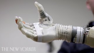 A Robotic Arm Controlled by the Mind  The New Yorker [upl. by Alrak199]