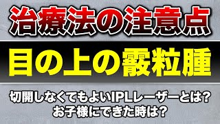 【霰粒腫】目の上のできもの 霰粒腫の治療方法とIPLレーザー治療について [upl. by Jeffry]