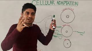 Cellular adaptation part 2  Atrophy and hypertrophy  by Dr aqib [upl. by Akire673]