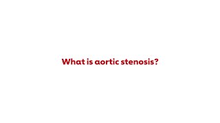 Target Aortic Stenosis – What is Aortic Stenosis [upl. by Natal515]