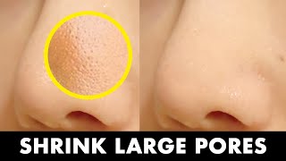 5STEP Dermatologists Tip to Shrink Large Pores How to Tighten amp Unclog Pores [upl. by Nelo]