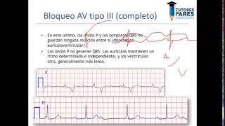 Arritmias en el electrocardiograma [upl. by Zzaj36]