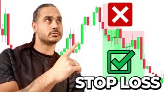 5 RULES You Must Follow When Placing Your STOP LOSS [upl. by Lraep]