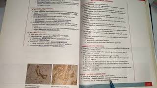 Pathoma Chapter 17 CNS PAthology Part 01 [upl. by Htiduj352]