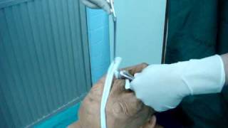 Anterior nasal packing ENT PMK [upl. by Ahsercel]