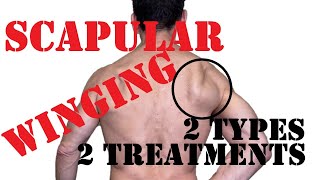 Scapular Winging Fix  Treat Medial And Lateral Winging [upl. by Kcirddot]