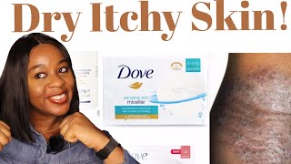 Get Rid of Skin Rashes caused by Dry Flaky Itchy Skin using Two Products [upl. by Adnorhs]