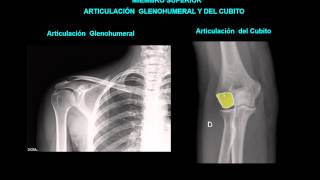 ANATOMIA RADIOLOGICA DEL MIEMBRO SUPERIOR [upl. by Elburr648]