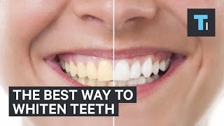 The best way to whiten teeth [upl. by Larry]