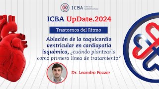 Ablación de la taquicardia ventricular en cardiopatía isquémica [upl. by Swec727]