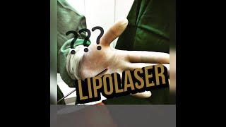 LIPOLASER  VIBROLIPO OU LIPO CONVENCIONAL QUAL ESCOLHER [upl. by O'Driscoll]