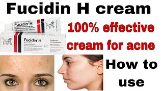 fucidin h cream uses in urdu For skin treatment of acne skin infectionsHow to use fusidin h cream [upl. by Enetsirhc]