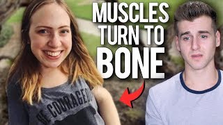 Meet The Girl Whose Muscles Are Turning Into Bone [upl. by Hoebart835]