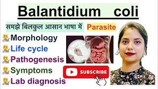 Balantidium coli in Hindi  Parasite  Morphology  Life Cycle  Symptoms  Hindi  Parasitology [upl. by Aramal]