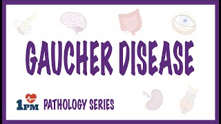 Gaucher Disease  Pathophysiology Diagnosis Treatment [upl. by Clotilde]