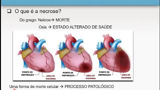 Necrose e apoptose 16  Patologia Geral [upl. by Nandor164]