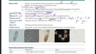 29 Casts in Urine  RBC cast  WBC casts  Granular Casts  Fatty casts  Waxy casts  Hyaline cast [upl. by Donnenfeld826]