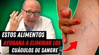 🔴Los 7 Mejores ALIMENTOS Que Derriten Los COÁGULOS De Sangre De Forma Natural [upl. by Convery891]