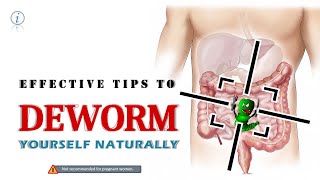 DEWORM NATURALLY An INSIGHT Dr Acsah AB Preventive Measures Food that kills intestinal worms [upl. by Nahtaoj65]