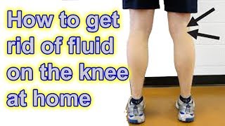 How to get rid of Fluid on The Knee at Home [upl. by Nivrehs]