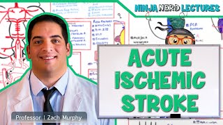 Acute Ischemic Stroke Etiology Pathophysiology Clinical Features Diagnostics Treatment [upl. by Aerona333]