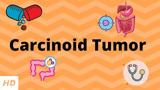 Carcinoid Tumor Causes Signs and Symptoms Diagnosis and Treatment [upl. by Ellertnom922]