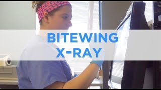 How to Perform a Bitewing XRay [upl. by Eiramlehcar625]