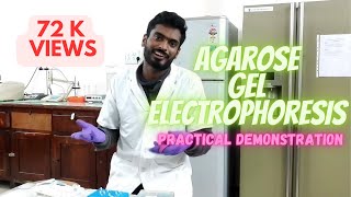 Agarose gel electrophoresis [upl. by Linus32]