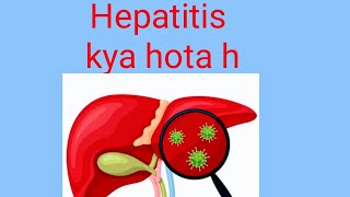 hepatitis bhepatitis chepatitishepatitis aviral hepatitishepatitis b treatment [upl. by Yelruc]