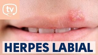 El herpes labial qué es causas y tratamiento [upl. by Anya]