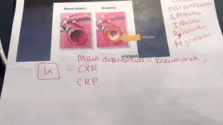 Acute bronchitis [upl. by Zetra]