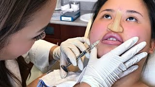 I INJECTED MY NOSE NO PERMENENT KIM THAI VLOG [upl. by Hamlani]