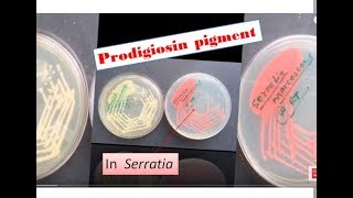 Prodigiosin pigment formation in Sarratia Serratia marcescens Prodigiosin [upl. by Lorianna]