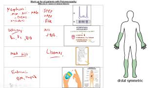 Morning Report Peripheral Neuropathy Mononeuritis Multiplex and approach to Paraproteinemia [upl. by Massingill]