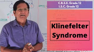 Klinefelter Syndrome  Grade 12 Biology [upl. by Essam]