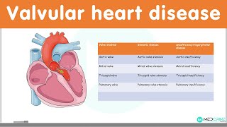 Valvular Heart Diseases Classification Causes Pathophysiology Diagnosis and Treatment [upl. by Allisan241]