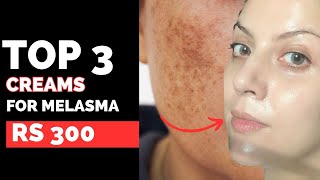 The Best 3 Creams For Rs 300 To Treat Melasma [upl. by Arnaldo]