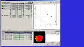 IGRT CBCT Adaptive [upl. by Lihas]