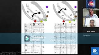 Video 4ta Clase Curso  Taller Electrocardiografía [upl. by Mott722]