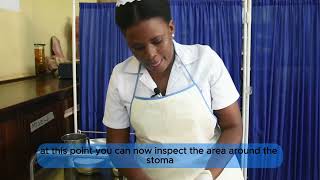 COLOSTOMY CARE By Tumusiime Anita [upl. by Rehpotsihc]