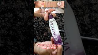 mederma advanced plus scar gel review amp demobest cream for scarhow to remove acne scars treatment [upl. by Pooi]