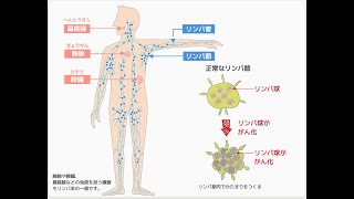 院内新聞803号youtube デュピルマブとリンパ腫 [upl. by Nolram]