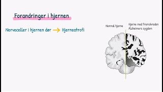 Nervesystemet Demens [upl. by Haneen]