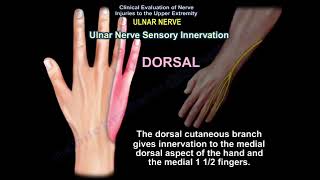 ULNAR NERVE INJURY CAUSES SYMPTOMS DIAGNOSIS AND TREATMENT Cubital tunnel syndrome [upl. by Darda344]